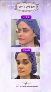 نمونه کار دکتر رزیتا دلقندی در مشهد