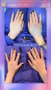 نمونه کار دکتر رزیتا دلقندی در مشهد