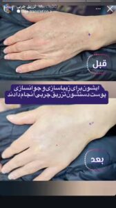 نمونه کار کلینیک بهاران در مشهد
