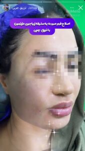 نمونه کار کلینیک بهاران در مشهد