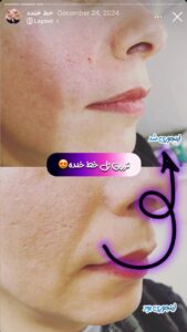 نمونه کار کلینیک بهاران در مشهد