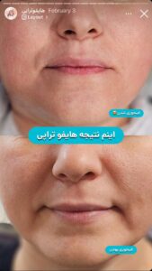 نمونه کار کلینیک بهاران در مشهد
