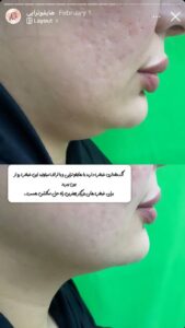 نمونه کار کلینیک بهاران در مشهد