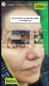 نمونه کار کلینیک بهاران در مشهد