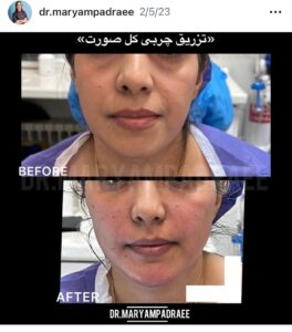 نمونه کار دکتر مریم پادرایی در مشهد