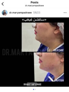 نمونه کار دکتر مریم پادرایی در مشهد