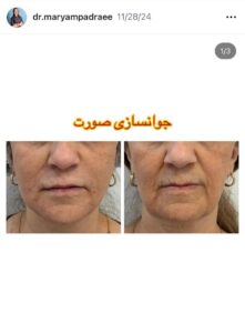 نمونه کار دکتر مریم پادرایی در مشهد