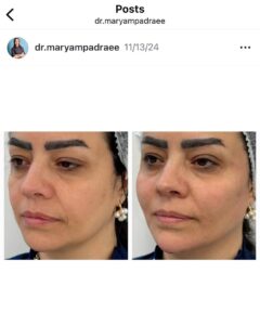 نمونه کار دکتر مریم پادرایی در مشهد
