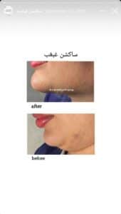نمونه کار دکتر مرضیه پیشگوی در مشهد
