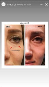 نمونه کار دکتر مرضیه پیشگوی در مشهد