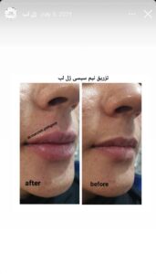 نمونه کار دکتر مرضیه پیشگوی در مشهد