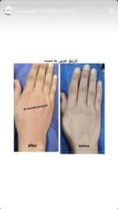 نمونه کار دکتر مرضیه پیشگوی در مشهد