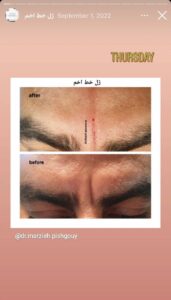 نمونه کار دکتر مرضیه پیشگوی در مشهد