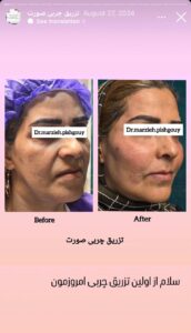 نمونه کار دکتر مرضیه پیشگوی در مشهد