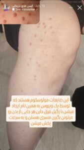 نمونه کار دکتر مرضیه پیشگوی در مشهد