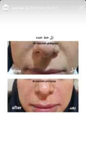 نمونه کار دکتر مرضیه پیشگوی در مشهد