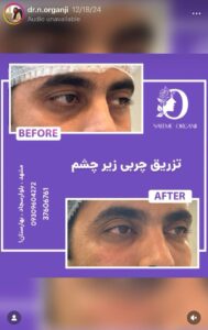 نمونه کار دکتر نعیمه ارگنجی در مشهد