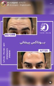 نمونه کار دکتر نعیمه ارگنجی در مشهد