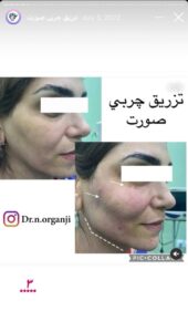 نمونه کار دکتر نعیمه ارگنجی در مشهد