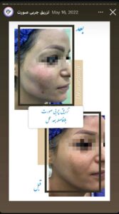 نمونه کار دکتر نعیمه ارگنجی در مشهد