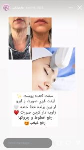 نمونه کار هایفوتراپی (کلینیک لاغری طراوت)