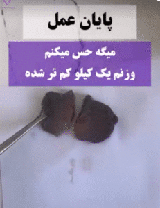 نمونه عمل لابیاپلاستی دکتر مهناز شادیان