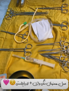 نمونه عمل لابیاپلاستی دکتر سحر محمدی