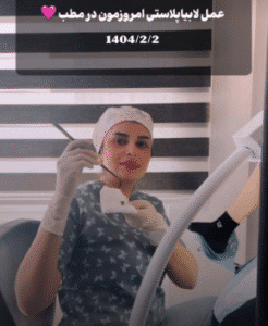 نمونه عمل لابیاپلاستی دکتر سحر محمدی