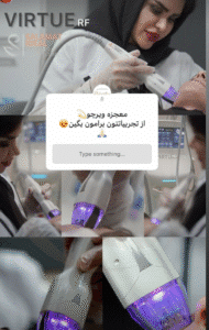 نمونه میکرونیدلینگ به روش آر اف ویرچو کلینیک سلامت ایده ال