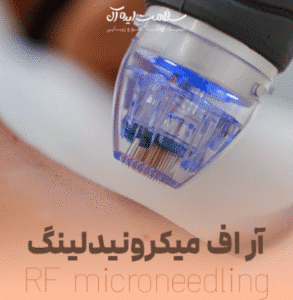 نمونه میکرونیدلینگ به روش آر اف کلینیک سلامت ایده ال