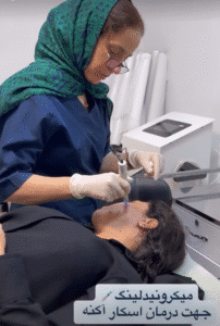 نمونه میکرونیدلینگ دکتر زهره سیدی