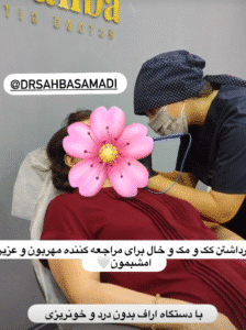 نمونه برداشتن خال دکتر صهبا صمدی