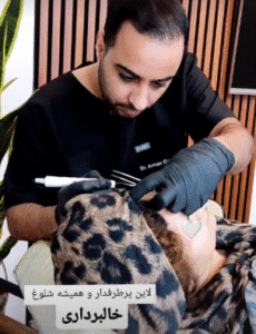 نمونه برداشتن خال کلینیک زیبایی آرمان