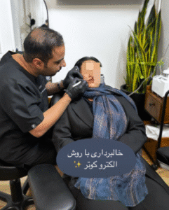 نمونه برداشتن خال کلینیک زیبایی آرمان