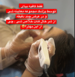 نمونه برداشتن خال کلینیک زیبایی گلدن رویال