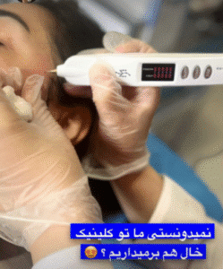 نمونه برداشتن خال کلینیک زیبایی گلدن رویال