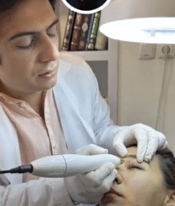 نمونه برداشتن خال دکتر سیاوش وکیلی