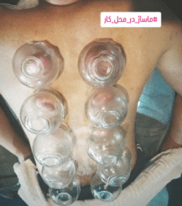 نمونه ماساژ مرکز ماساژ ماه