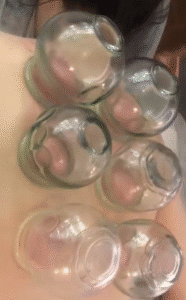 نمونه ماساژ مرکز ماساژ نورا