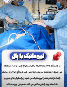 نمونه لیپوماتیک دکتر احمد یکتا
