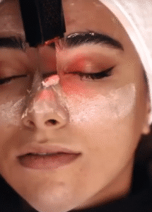 نمونه پاکسازی پوست (کلینیک تخصصی آفرینش)