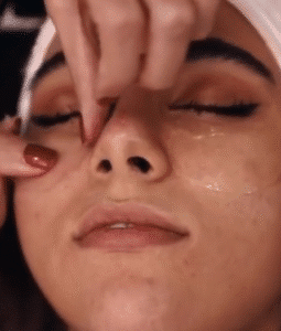 نمونه پاکسازی پوست (کلینیک تخصصی آفرینش)