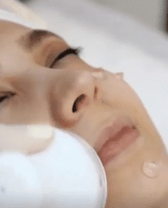 نمونه پاکسازی پوست (کلینیک تخصصی آفرینش)