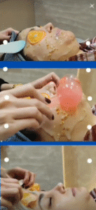 نمونه پاکسازی پوست (کلینیک تخصصی آفرینش)