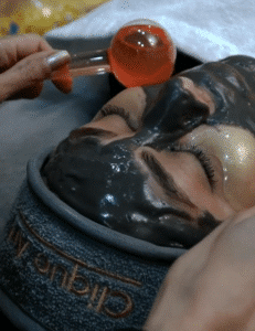 نمونه پاکسازی پوست (کلینیک تخصصی آفرینش)