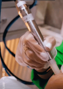 نمونه پاکسازی پوست (کلینیک تخصصی آفرینش)