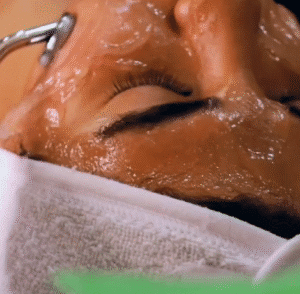 نمونه پاکسازی پوست (کلینیک تخصصی آفرینش)