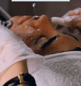 نمونه پاکسازی پوست (کلینیک تخصصی آفرینش)