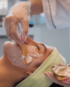 نمونه پاکسازی پوست (کلینیک تخصصی آفرینش)