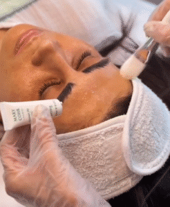 نمونه پاکسازی پوست (کلینیک تخصصی آفرینش)